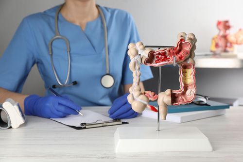 4 способа оздоровить кишечник и улучшить пищеварение