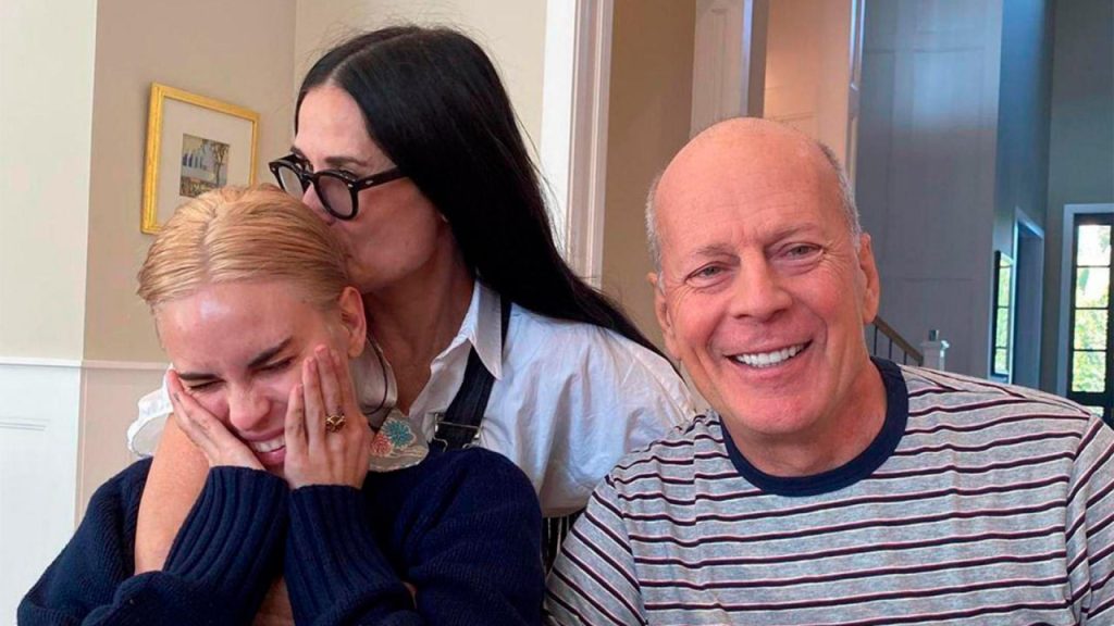 Как развивается болезнь, которая поразила Брюса Уиллиса? Как развивается болезнь, поразившая Брюса Уиллиса?