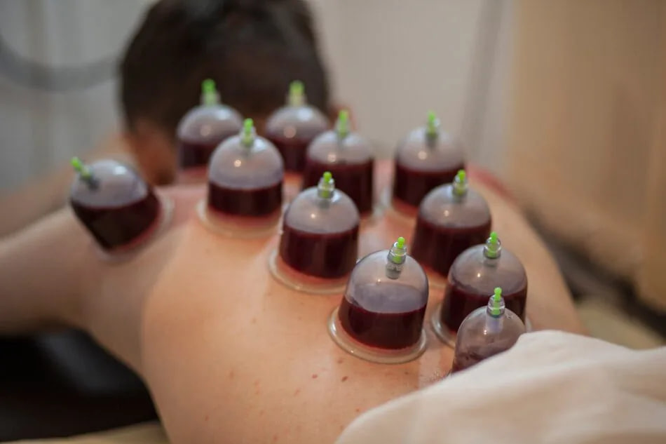 Как хиджама привела к смерти в Узгене: почему это опасно