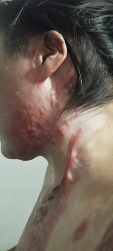 Муж поджёг жену в Таласской области: новые детали дела