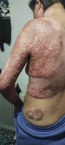 Муж поджёг жену в Таласской области: новые детали дела